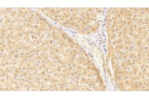 Detection of IL1a in Human Liver Tissue using Polyclonal Antibody to Interleukin 1 Alpha (IL1a) (IL1A Antikörper  (AA 113-271))