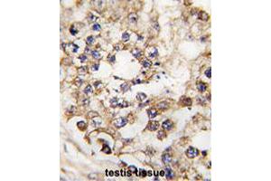 Formalin-fixed and paraffin-embedded human testis tissue reacted with PDX1 polyclonal antibody  , which was peroxidase-conjugated to the secondary antibody, followed by DAB staining. (PDX1 Antikörper  (N-Term))