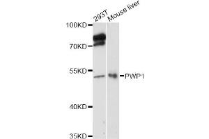 Western blot analysis of extracts of various cell lines, using PWP1 antibody (ABIN6293029) at 1:3000 dilution. (PWP1 Antikörper)