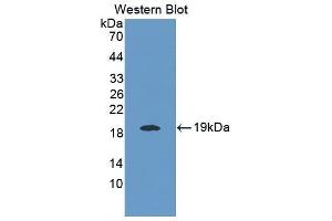 Western Blotting (WB) image for anti-Interleukin 25 (IL25) (AA 33-169) antibody (ABIN1868646) (IL-25 Antikörper  (AA 33-169))