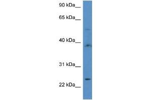 WB Suggested Anti-ACOT9 Antibody Titration: 1.