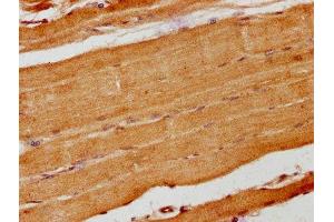 IHC image of ABIN7157686 diluted at 1:200 and staining in paraffin-embedded human skeletal muscle tissue performed on a Leica BondTM system. (ANKRD15 Antikörper  (AA 66-255))
