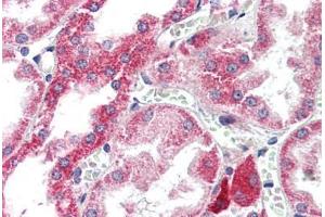 Human Kidney (formalin-fixed, paraffin-embedded) stained with ATG7 antibody ABIN307175 at 5 ug/ml followed by biotinylated goat anti-rabbit IgG secondary antibody ABIN481713, alkaline phosphatase-streptavidin and chromogen. (ATG7 Antikörper  (C-Term))