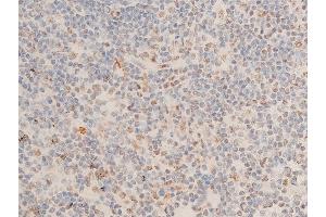 ABIN6267073 at 1/100 staining human appendiceal tissue sections by IHC-P. (CHEK1 Antikörper  (pSer280))
