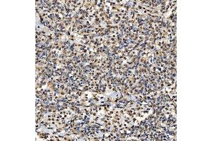 IHC analysis of SNRPD2 using anti-SNRPD2 antibody (ABIN7598963).