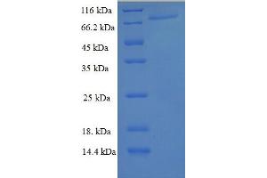 SDS-PAGE (SDS) image for Peroxisome Proliferator-Activated Receptor gamma (PPARG) (AA 1-477) protein (His-SUMO Tag) (ABIN5710133) (PPARG Protein (AA 1-477) (His-SUMO Tag))