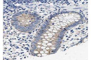 ABIN6267481 at 1/100 staining human colon tissue sections by IHC-P. (NOS2 Antikörper  (pTyr151))