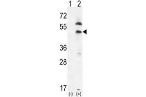 Western blot analysis of PDGFRL and 293 cell lysate either nontransfected (Lane 1) or transiently transfected (2) with the PDGFRL gene. (PDGFRL Antikörper  (AA 328-357))