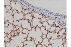 ABIN6267337 at 1/200 staining Mouse lung tissue sections by IHC-P. (IGF1R Antikörper  (pTyr1161))
