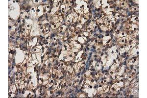 Immunohistochemistry (IHC) image for anti-Destrin (Actin Depolymerizing Factor) (DSTN) antibody (ABIN1497910) (Destrin Antikörper)