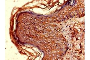 Immunohistochemistry of paraffin-embedded human skin tissue using ABIN7155597 at dilution of 1:100 (HLA-DQB1 Antikörper  (AA 128-175))