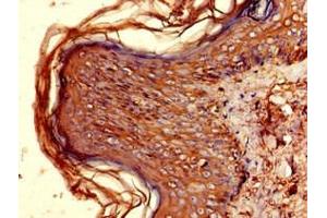 Immunohistochemistry of paraffin-embedded human skin tissue using ABIN7155597 at dilution of 1:100