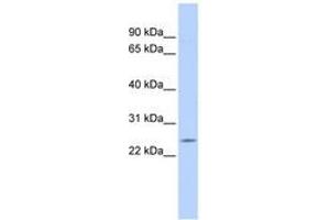 Image no. 1 for anti-Proteasome (Prosome, Macropain) Subunit, beta Type, 5 (PSMB5) (AA 72-121) antibody (ABIN6744083) (PSMB5 Antikörper  (AA 72-121))