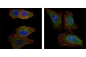 Immunofluorescence analysis of PANC-1 (left) and Hela (right) cells using AKT2 mouse mAb (green). (AKT2 Antikörper)