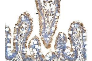 KARS antibody was used for immunohistochemistry at a concentration of 4-8 ug/ml to stain Epithelial cells of intestinal villus (arrows) in Human Intestine. (KARS Antikörper  (C-Term))