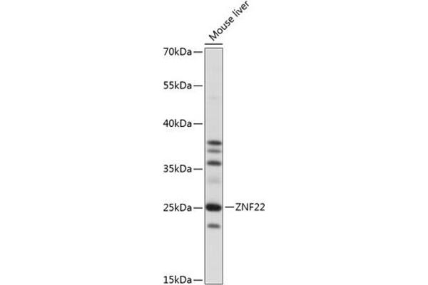 Zinc Finger Protein 22 Antikörper  (AA 1-224)