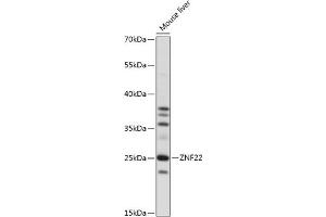 Western blot analysis of extracts of mouse liver, using ZNF22 antibody (ABIN7271468) at 1:1000 dilution. (Zinc Finger Protein 22 Antikörper  (AA 1-224))