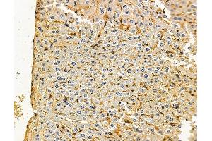 ABIN7096146 and ABIN7100208 at 1/100 staining mouse liver tissue by IHC-P.