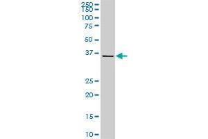 CDX4 monoclonal antibody (M06), clone 3F3. (CDX4 Antikörper  (AA 71-170))