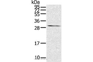 Western blot analysis of Mouse kidney tissue, using TNFSF15 Polyclonal Antibody at dilution of 1:600 (TNFSF15 Antikörper)