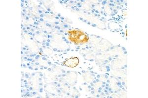 Immunohistochemistry of paraffin embedded rat pancreatic using MADCAM1 (ABIN7074695) at dilution of 1:1800 (400x lens) (MADCAM1 Antikörper)