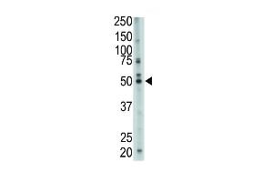 The anti-FDFT1 Pab (ABIN389051 and ABIN2839260) is used in Western blot to detect FDFT1 in mouse cerebellum tissue lysate. (FDFT1 Antikörper  (N-Term))