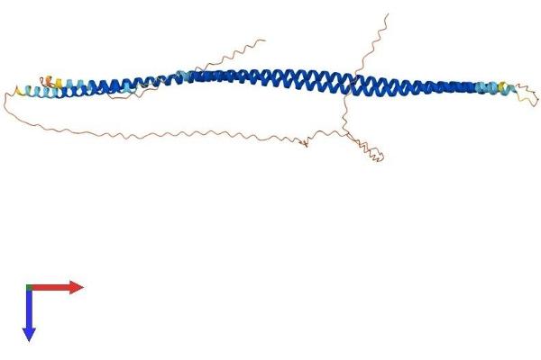 KRT16 Protein (AA 1-469) (His tag)