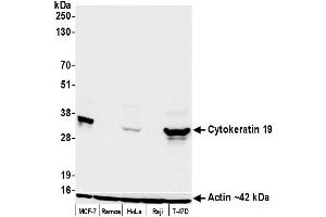 Western Blotting (WB) image for anti-Keratin 19 (KRT19) antibody (ABIN7449419) (Cytokeratin 19 Antikörper)