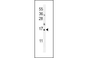 Hrk-BH3 (ABIN388104 and ABIN2846212) western blot analysis in mouse kidney tissue lysates (35 μg/lane). (HRK Antikörper  (AA 15-50))