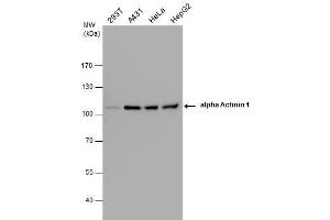 WB Image alpha Actinin 1 antibody detects alpha Actinin 1 protein by western blot analysis. (ACTN1 Antikörper)