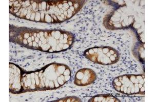 Image no. 1 for anti-ADP-Ribosylation Factor Interacting Protein 1 (ARFIP1) (AA 1-102) antibody (ABIN599550) (ARFIP1 Antikörper  (AA 1-102))
