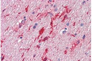 Human Brain, Cerebellum, White Matter (formalin-fixed, paraffin-embedded) stained with HGF antibody ABIN461958 at 10 ug/ml followed by biotinylated anti-mouse IgG secondary antibody ABIN481714, alkaline phosphatase-streptavidin and chromogen. (HGF Antikörper)
