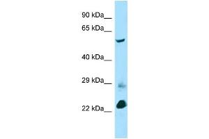 Host: Rabbit Target Name: Btbd3 Sample Type: Mouse Lung lysates Antibody Dilution: 1. (BTBD3 Antikörper  (C-Term))