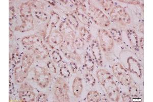 Formalin-fixed and paraffin embedded human kidney tissue labeled with Anti-THEMIS Polyclonal Antibody, Unconjugated 1:400 followed by conjugation to the secondary antibody and DAB staining (THEMIS Antikörper  (AA 301-400))