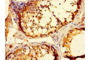 Immunohistochemistry of paraffin-embedded human testis tissue using ABIN7173195 at dilution of 1:100 (TMEM27 Antikörper  (AA 206-265))