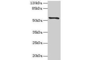 Western blot All lanes: TMEM161A antibody at 1 μg/mL + PC-3 whole cell lysate Secondary Goat polyclonal to rabbit IgG at 1/10000 dilution Predicted band size: 54, 42 kDa Observed band size: 54 kDa (TMEM161A Antikörper  (AA 29-98))