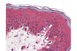 Immunohistochemistry (IHC) image for anti-Nuclear Receptor Subfamily 1, Group D, Member 2 (NR1D2) (N-Term) antibody (ABIN1049134)