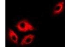 Immunofluorescent analysis of ASL staining in Hela cells.