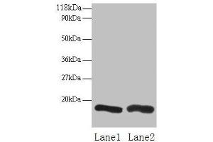 CHMP2A antibody  (AA 1-222)