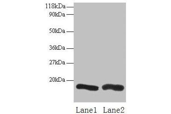 CHMP2A Antikörper  (AA 1-222)