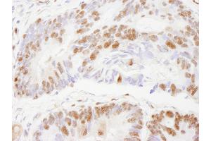 Immunohistochemistry (IHC) image for anti-Zinc Finger Protein 295 (ZNF295) (AA 875-925) antibody (ABIN7448882) (ZNF295 Antikörper  (AA 875-925))