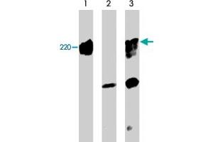 Western blots showing mouse brain (lane 1), and COS-7 cells untransfected (lane 2) or transfected with mouse myc-tagged PLXNA1 (lane 3). (Plexin A1 Antikörper)