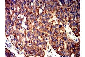 Immunohistochemistry (IHC) image for anti-BCL2-Like 2 (BCL2L2) (AA 6-118) antibody (ABIN5611241)