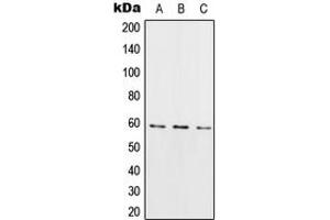 Western blot analysis of RIOK3 expression in HeLa (A), Raw264. (RIOK3 Antikörper  (Center))