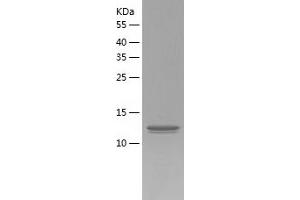 Western Blotting (WB) image for Potassium Channel, Subfamily V, Member 2 (KCNV2) (AA 12-154) protein (His tag) (ABIN7124532) (KCNV2 Protein (AA 12-154) (His tag))