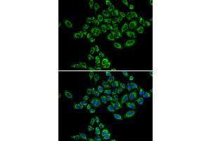 Immunofluorescence analysis of HeLa cells using SRPK1 antibody (ABIN5973465). (SRPK1 Antikörper)