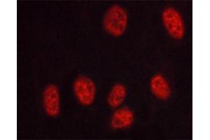 ABIN6267569 staining HUVEC cells treated with serum 20% 30' by ICC/IF. (PRKDC Antikörper  (pThr2647))