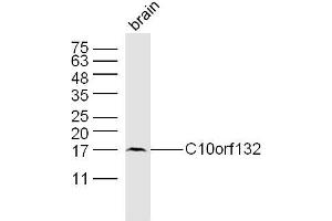 Mouse brain lysates probed with C10orf132 Polyclonal Antibody, Unconjugated  at 1:300 dilution and 4˚C overnight incubation. (GOLGA7B Antikörper)