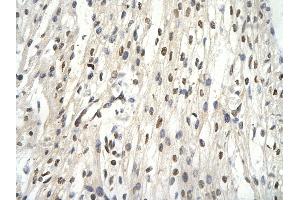 Rabbit Anti-GTF2E2 Antibody       Paraffin Embedded Tissue:  Human cardiac cell   Cellular Data:  Epithelial cells of renal tubule  Antibody Concentration:   4.