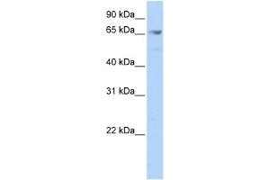 WB Suggested Anti-MEF2A Antibody Titration:  0. (MEF2A Antikörper  (Middle Region))